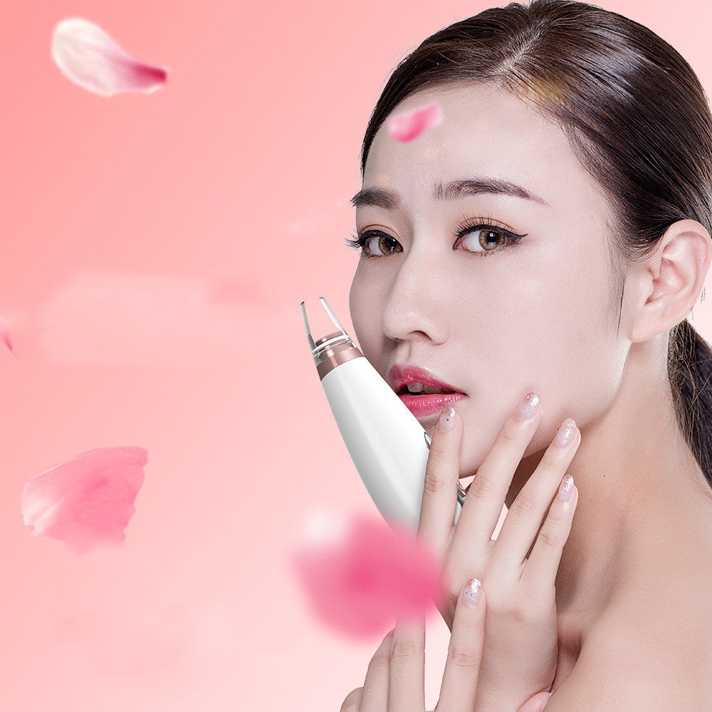 ZyraBeauty Microcrystalline Facial Pore Cleanser – Gentle Extraction Device for Blackheads & Skin Renewal