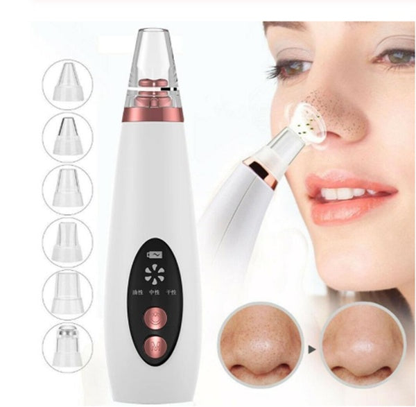 ZyraBeauty Microcrystalline Facial Pore Cleanser – Gentle Extraction Device for Blackheads & Skin Renewal