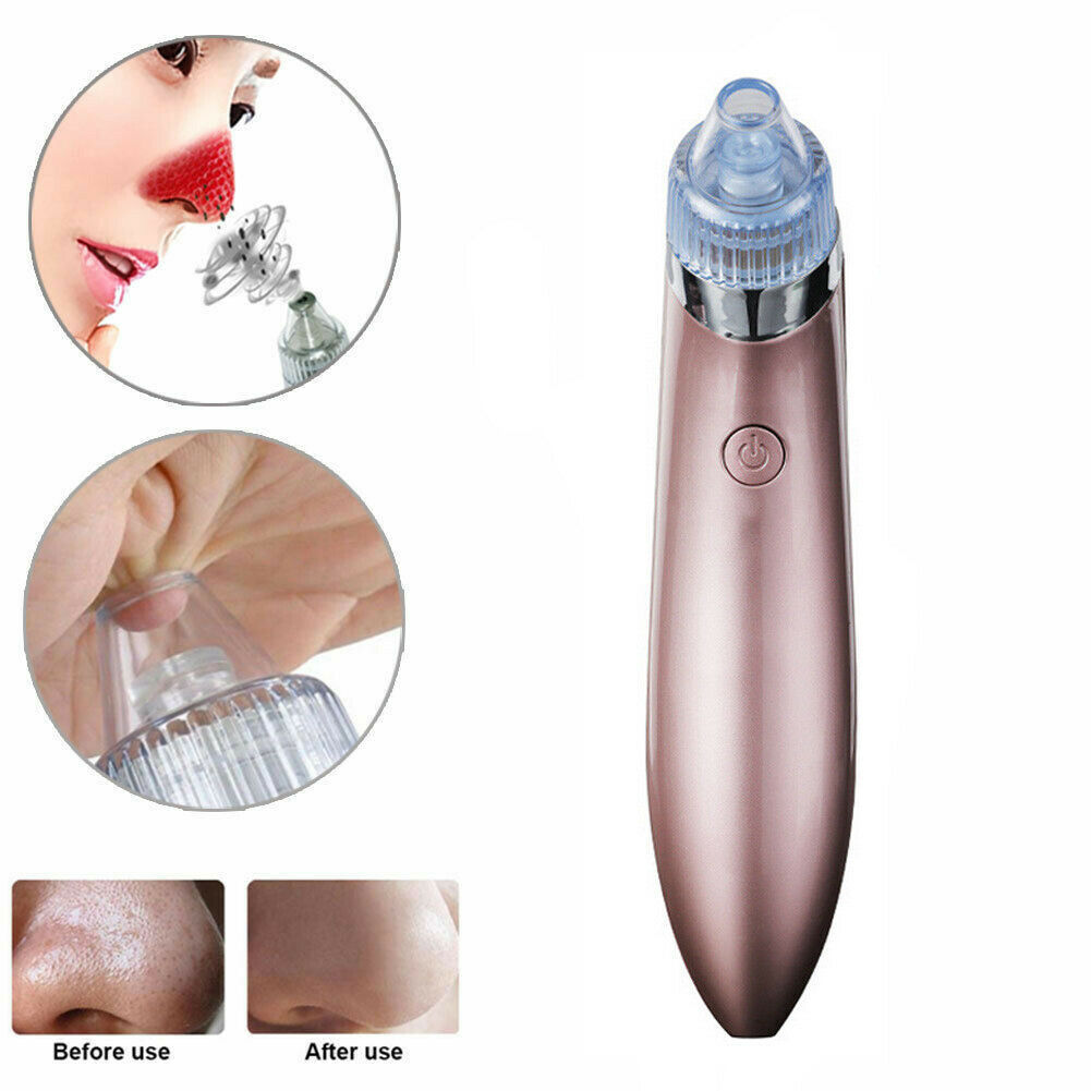 ZyraBeauty Electric Blackhead Remover & Pore Vacuum – Acne Extractor with 4 Heads, 2-Level Suction & Diamond Dermabrasion for Smooth, Clean Skin