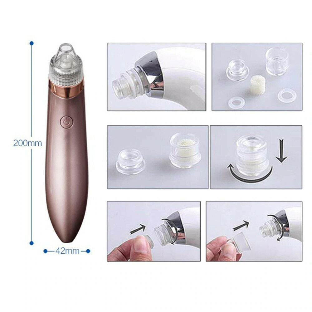 ZyraBeauty Electric Blackhead Remover & Pore Vacuum – Acne Extractor with 4 Heads, 2-Level Suction & Diamond Dermabrasion for Smooth, Clean Skin