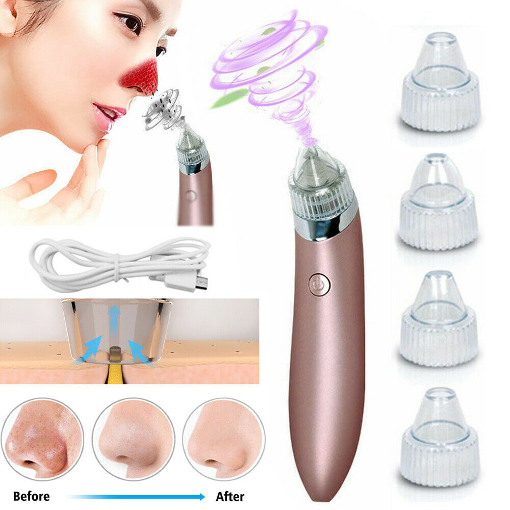 ZyraBeauty Electric Blackhead Remover & Pore Vacuum – Acne Extractor with 4 Heads, 2-Level Suction & Diamond Dermabrasion for Smooth, Clean Skin