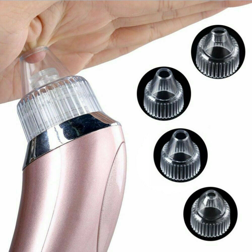 ZyraBeauty Electric Blackhead Remover & Pore Vacuum – Acne Extractor with 4 Heads, 2-Level Suction & Diamond Dermabrasion for Smooth, Clean Skin