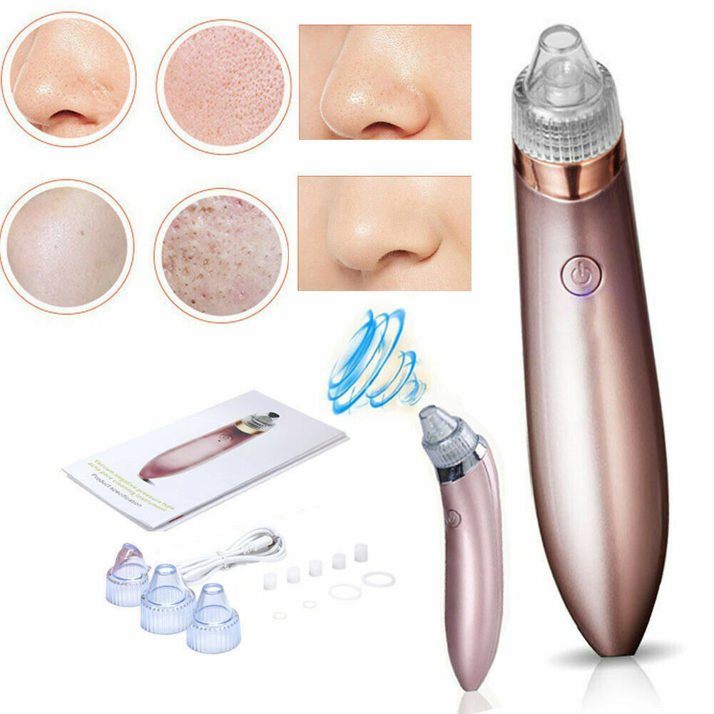 ZyraBeauty Electric Blackhead Remover & Pore Vacuum – Acne Extractor with 4 Heads, 2-Level Suction & Diamond Dermabrasion for Smooth, Clean Skin